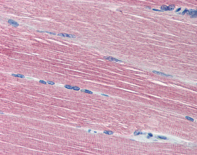 Immunohistochemistry analysis of formalin fixed, paraffin embedded Human skeletal muscle tissue using 20µg/ml ab78228.