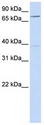 Anti-C17orf80 antibody (ab82806) at 1 µg/ml (in 5% skim milk / PBS buffer) + Hela cell lysate at 10 µgSecondaryHRP conjugated anti-Rabbit IgG at 1/50000 dilution
