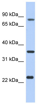Anti-C17orf82 antibody (ab94492) at 1 µg/ml (in 5% skim milk / PBS buffer) + LN18 cell lysate at 10 µgSecondaryHRP conjugated anti-Rabbit IgG at 1/50000 dilution