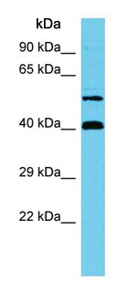Anti-C17orf85 antibody - C-terminal (ab157620) at 1 µg/ml + Jurkat whole cell lysate at 10 µg