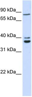 Anti-C18orf10 antibody (ab83914) at 1 µg/ml (in 5% skim milk/ PBS buffer) + 293T cell lysate at 10 µg with gel concentration: 12%SecondaryHRP conjugated anti-Rabbit at 1/50000 dilution