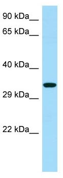 Anti-C18orf22 antibody (ab128645) at 1 µg/ml + HeLa cell lysate at 10 µgSecondaryGoat anti-Rabbit IgG HRP