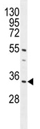 Anti-C18orf25 antibody (ab107064) at 1/100 dilution + Mouse heart tissue lysate at 35 µg