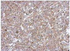 Immunohistochemical analysis of paraffin-embedded Human HeLa xenograft tissue labeling C18orf25 with ab151616 at 1/500 dilution.