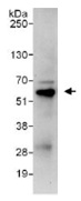 Detection of Human C18orf25 by Immunoprecipitation in Whole cell lysate (1 mg for IP, 20% of IP loaded) from HeLa cells using ab123602 6 ug/mg lysate. Subsequent WB detection was performed using ab123602 at 1 ug/mg. Detection: Chemiluminescence with an exposure time of 30 seconds.