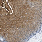 ab121336 at 1/25 dilution staining C18orf26 in Paraffin-embedded Human esophagus tissue by Immunohistochemistry.