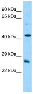 Anti-C18orf26 antibody - N-terminal (ab140299) at 1 µg/ml + MCF7 lysate at 10 µg