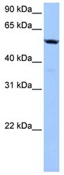 Anti-C18orf54 antibody (ab81233) at 1 µg/ml (in 5% skim milk / PBS buffer) + Hela cell lysate at 10 µgSecondaryHRP conjugated anti-Rabbit IgG at 1/50000 dilution