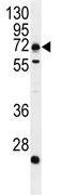 Anti-C18orf8 antibody (ab111531) at 1/50 dilution + MDA-MB231 cell line lysates at 35 µg