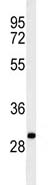 Anti-C19orf18 antibody (ab103434) at 1/100 dilution + Ramos cell line lysates at 35 µg