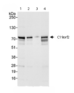 All lanes : Anti-C19orf2 antibody (ab72134) at 0.04 µg/mlLane 1 : Whole cell lysate from Hela cells at 50 µgLane 2 : Whole cell lysate from Hela cells at 15 µgLane 3 : Whole cell lysate from Hela cells at 5 µgLane 4 : Whole cell lysate from 293T cells at 50 µg