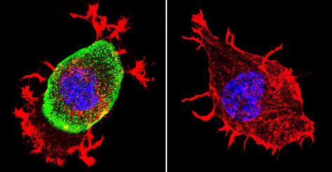 Immunocytochemistry/Immunofluorescence analysis of Acetylcholinesterase shows staining in Neuro-2a cells. Acetylcholinesterase staining (green), F-Actin staining with Phalloidin (red) and nuclei with DAPI (blue) is shown. Cells were grown on chamber slides and fixed with formaldehyde prior to staining. Cells were incubated without (control) or with ab2803 (1:200) overnight at 4°C, washed with PBS and incubated with a DyLight-488 conjugated secondary antibody. Images were taken at 60X magnification.