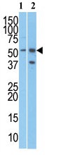 All lanes : Anti-C19orf2 antibody - Carboxyterminal end (ab71591) at 1/250 dilutionLane 1 : T47D cell lysateLane 2 : Jurkat cell lysateLysates/proteins at 12.5 µg per lane.
