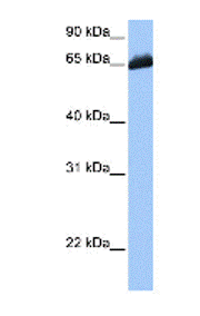 Anti-C19orf21 antibody (ab81302) at 1 µg/ml (in 5% skim milk / PBS buffer) + HepG2 cell lysate at 10 µgSecondaryHRP conjugated anti-Rabbit IgG at 1/50000 dilution