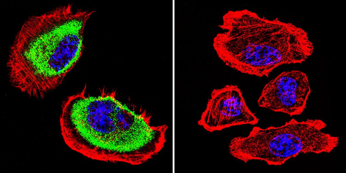 Immunocytochemistry/Immunofluorescence analysis of Acetylcholinesterase shows staining in U251 cells. Acetylcholinesterase staining (green), F-Actin staining with Phalloidin (red) and nuclei with DAPI (blue) is shown. Cells were grown on chamber slides and fixed with formaldehyde prior to staining. Cells were incubated without (control) or with ab2803 (1:200) overnight at 4°C, washed with PBS and incubated with a DyLight-488 conjugated secondary antibody. Images were taken at 60X magnification.