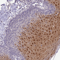 Immunohistochemical analysis of Paraffin-embedded Human esophagus tissue labeling C19orf25 with ab151093 at 1/200 dilution.