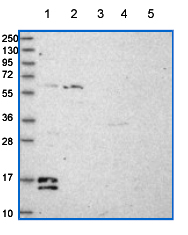 All lanes : Anti-C19orf25 antibody (ab151093) at 1/100 dilutionLane 1 : RT4 lysateLane 2 : U 251 MG lysateLane 3 : Human plasma lysateLane 4 : Human liver lysateLane 5 : Human tonsil lysate