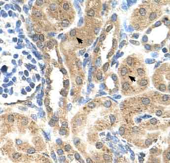 Immunohistochemistry (Formalin/PFA-fixed paraffin-embedded sections) analysis of human kidney tissue labelling C19orf28 with ab64464 at 4-8µg/ml. Arrows indicate epithelial cells of the renal tubule. Magnification: 400X.