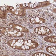 ab122734 at 1/200 dilution staining C19orf44 in Paraffin-embedded Human rectum tissue by Immunohistochemistry.
