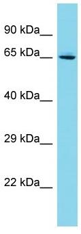 Anti-C19orf44 antibody - N-terminal (ab157663) at 1 µg/ml + Jurkat whole cell lysate at 10 µg
