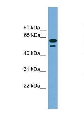 Anti-C19orf45 antibody (ab105831) at 1 µg/ml + Transfected 293T cell lysate at 10 µg