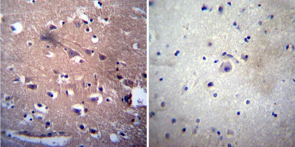 Immunohistochemistry was performed on both normal and cancer biopsies of deparaffinized human Brain tissue. To expose target proteins, heat induced antigen retrieval was performed using 10mM sodium citrate (pH6.0) buffer, microwaved for 8-15 minutes. Following antigen retrieval tissues were blocked in 3% BSA-PBS for 30 minutes at room temperature. Tissues were then probed at a dilution of 1:200 with a mouse monoclonal antibody recognizing Acetylcholinesterase (ab2803) or without primary antibody (negative control) overnight at 4°C in a humidified chamber. Tissues were washed extensively with PBST and endogenous peroxidase activity was quenched with a peroxidase suppressor. Detection was performed using a biotin-conjugated secondary antibody and SA-HRP, followed by colorimetric detection using DAB. Tissues were counterstained with hematoxylin and prepped for mounting.