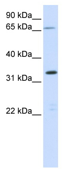 Anti-C19orf47 antibody (ab82637) at 1 µg/ml + fetal muscle lysate at 10 µgSecondaryHRP conjugated anti-Rabbit IgG at 1/50000 dilution