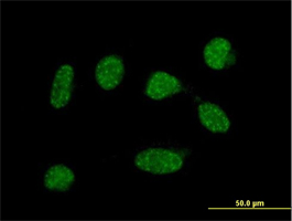 Immunofluorescent analysis of HeLa cells labeling C19orf50 with ab168160 at 10µg/ml. Note: purification with protein A is required before use in immunofluorescence applications