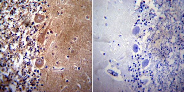 Immunohistochemistry was performed on both normal and cancer biopsies of deparaffinized human Cerebellum tissue. To expose target proteins, heat induced antigen retrieval was performed using 10mM sodium citrate (pH6.0) buffer, microwaved for 8-15 minutes. Following antigen retrieval tissues were blocked in 3% BSA-PBS for 30 minutes at room temperature. Tissues were then probed at a dilution of 1:50 with a mouse monoclonal antibody recognizing Acetylcholinesterase (ab2803) or without primary antibody (negative control) overnight at 4°C in a humidified chamber. Tissues were washed extensively with PBST and endogenous peroxidase activity was quenched with a peroxidase suppressor. Detection was performed using a biotin-conjugated secondary antibody and SA-HRP, followed by colorimetric detection using DAB. Tissues were counterstained with hematoxylin and prepped for mounting.