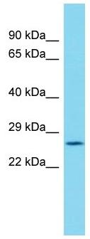 Anti-C19orf52 antibody - C-terminal (ab157607) at 1 µg/ml + Human placenta lysate at 10 µg
