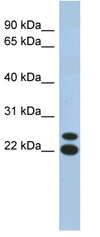 Anti-C19orf54 antibody (ab90015) at 1 µg/ml + Human fetal muscle lysate at 10 µgSecondaryanti-Rabbit IgG HRP at 1/50000 dilution