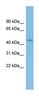 Anti-C19orf55 antibody (ab101968) at 1 µg/ml + NCI-H226 cell lysate at 10 µg