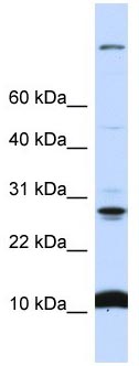 Anti-C19orf56 antibody (ab105681) at 1 µg/ml + 721_B cell lysate at 10 µg