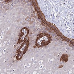 ab126385, at 1/200 dilution, staining C19orf57 in paraffin-embedded Human esophagus tissue by immunohistochemistry.