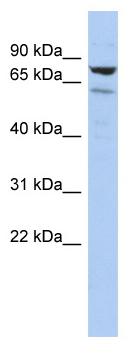 Anti-C1orf103 antibody (ab90686) at 1 µg/ml (in 5% skim milk / PBS buffer) + HepG2 cell lysate at 10 µgSecondaryHRP conjugated anti-Rabbit IgG at 1/50000 dilution