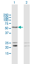 All lanes : Anti-C1orf103 antibody (ab167585) at 1 µg/mlLane 1 : C1orf103 transfected 293T cell lysateLane 2 : Non transfected 293T cell lysateLysates/proteins at 15 µl per lane.SecondaryGoat Anti-Mouse IgG (H&L)-HRP Conjugate secondary antibody at 1/2500 dilution