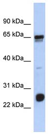 Anti-C1orf103 antibody (ab90736) at 1 µg/ml (in 5% skim milk / PBS buffer) + Placenta lysate at 10 µgSecondaryHRP conjugated anti-Rabbit IgG at 1/50000 dilution