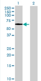 All lanes : Anti-C1orf103 antibody (ab68758) at 1/500 dilutionLane 1 : C1orf103 transfected 293T cell lysateLane 2 : Non-transfected 293T cell lysateLysates/proteins at 25 µg per lane.SecondaryGoat anti-mouse IgG (H&L)-HRP conjugate at 1/2500 dilution