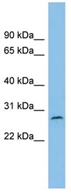 Anti-C1orf104 antibody (ab101964) at 1 µg/ml + ACHN cell lysate at 10 µg