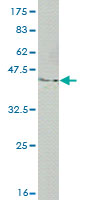 Western blot against tagged recombinant protein immunogen using ab56843 ACF1 / BAZ1A antibody at 1ug/ml.