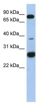 Anti-C1orf110 antibody (ab87742) at 1 µg/ml (in 5% skim milk / PBS buffer) + human fetal heart lysate at 10 µgSecondaryHRP conjugated anti-Rabbit IgG at 1/50000 dilution