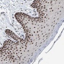 ab121774 at 1/50 dilution staining C1orf112 in Paraffin embedded Human oral mucosa tissue by Immunohistochemistry.