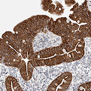 ab121815, at 1/300 dilution, staining C1orf112 in paraffin-embedded Human duodenum tissue by Immunohistochemistry.
