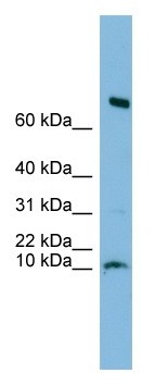 Anti-C1orf122 antibody (ab102659) at 1 µg/ml + Human fetal heart lysate at 10 µg