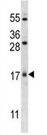 Anti-C1orf144 antibody (ab124097) at 1/100 dilution + U251 cell line lysate at 35 µg