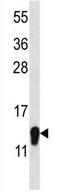 Anti-C1orf144 antibody (ab124097) at 1/100 dilution + Mouse liver tissue lysate at 35 µg