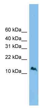 Anti-C1orf144 antibody (ab102041) at 1 µg/ml + RPMI-8226 cell lysate at 10 µg