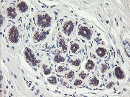 Immunohistochemical analysis of paraffin embedded Human breast tissue labeling C1ORF151 with ab150339 at 1/150.