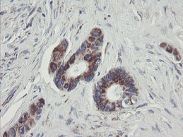 Immunohistochemical analysis of paraffin embedded Human colon tissue labeling C1ORF151 with ab150339 at 1/150.