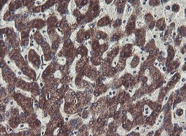 Immunohistochemical analysis of paraffin embedded Human liver tissue labeling C1ORF151 with ab150339 at 1/150.